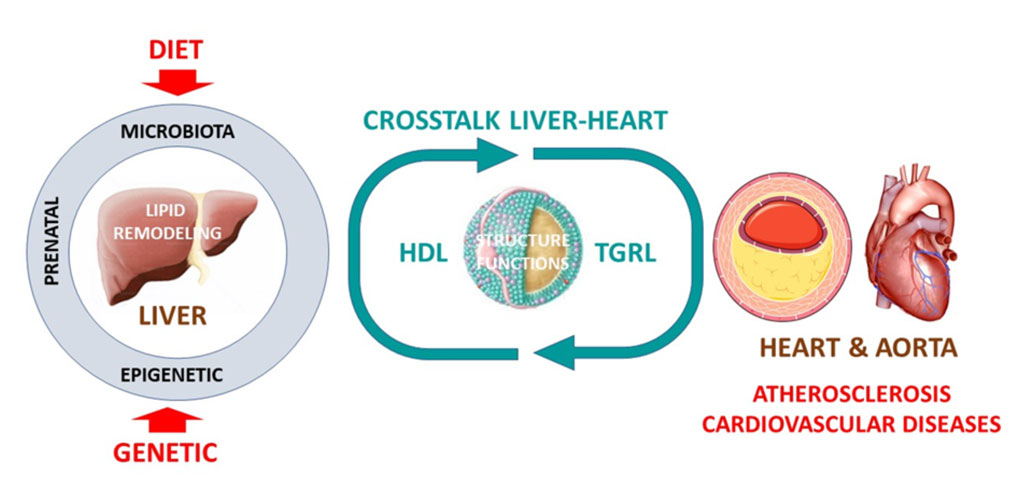 UMRS 1166 Team 4 research themes - Major research axes. HDL, high-density lipoprotein; TGRL, triglyceride-rich lipoprotein