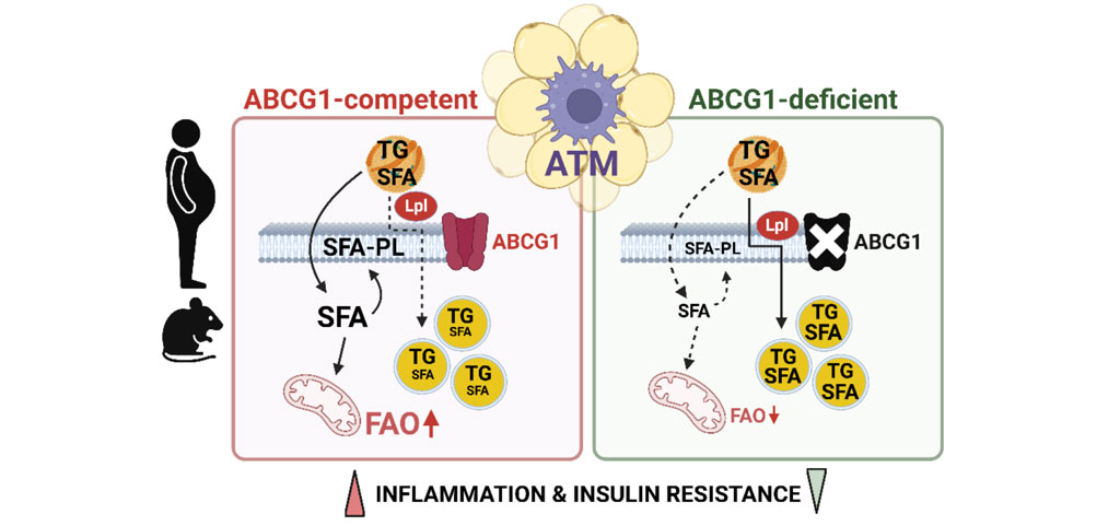 UMRS 1166 Team 4 research themes - Rewiring of fatty acids by ABCG1 orchestrates the metabolic activation of ATM and contributes to inflammation and insulin resistance in obesity