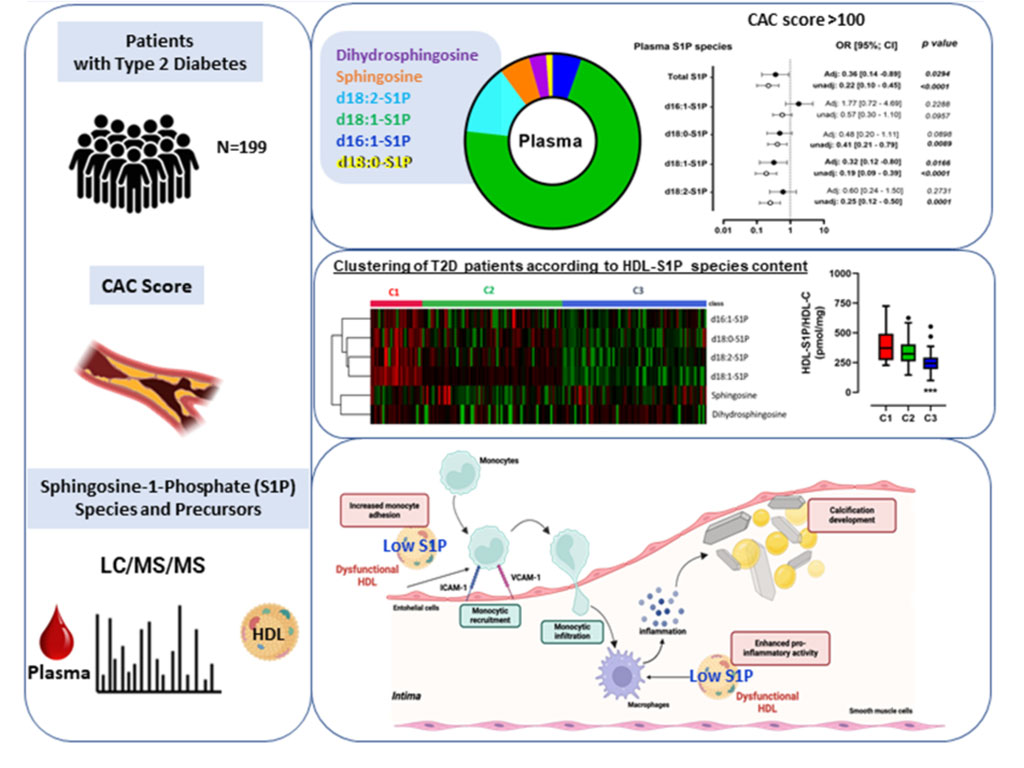 UMRS 1166 Team 4 research themes - Low HDL-S1P content is associated with a high CAC score and impaired anti-inflammatory activities T2D (Le Goff W. et al., Cardiovascular Diabetology, 2025)