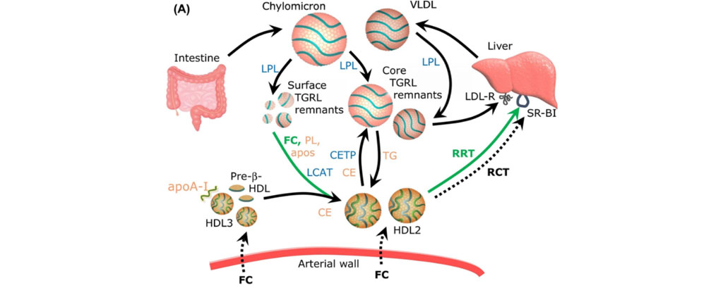 UMRS 1166 Team 4 research themes - HDL prevents surface TRL remnants from accumulation in the arterial wall via acquiring phospholipid (PL) and free cholesterol (FC) during TG lipolysis (Kontush A, Trends in Molecular Medicine, 2020)