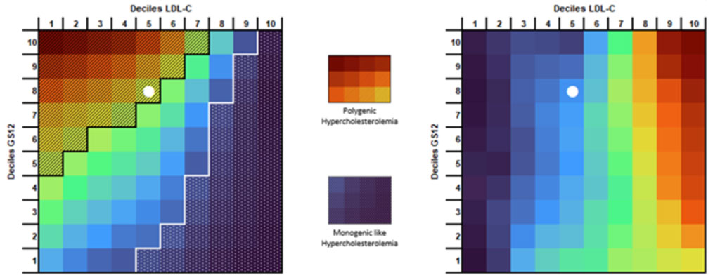 UMRS 1166 Team 4 research themes - A new score for predicting ASCVD risk in Familial Hypercholesterolemia