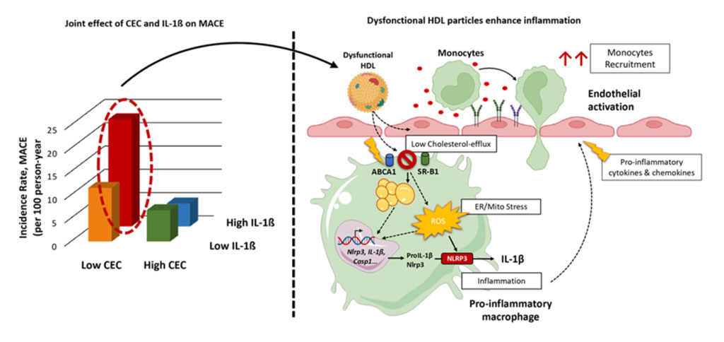 UMRS 1166 Team 4 research themes - Impaired cholesterol efflux capacity and elevated IL-1β synergistically increase the residual cardiovascular risk in MI patients