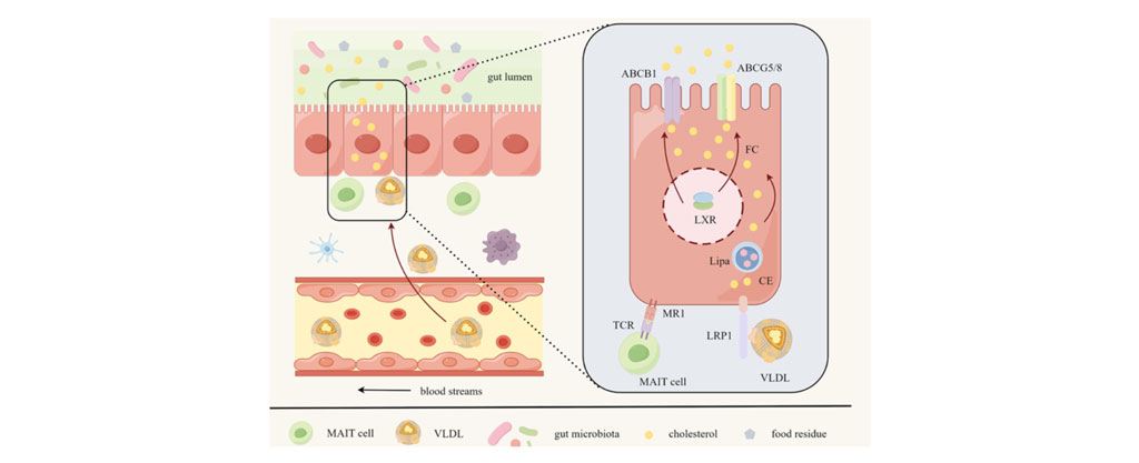 UMRS 1166 Team 4 research themes - MAIT Cells Promote Cholesterol Excretion Pathways Mitigating Atherosclerosis.