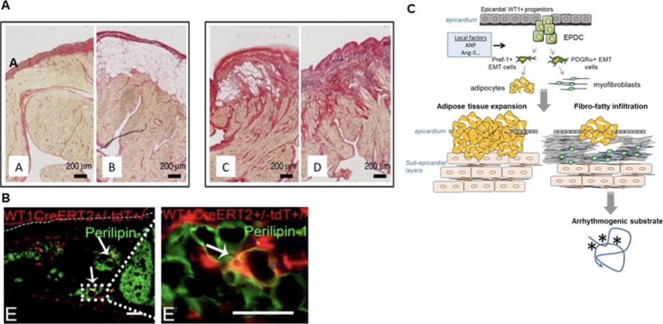 Epicardium is reactived early during the formation of the atrial cardiomyopathy and the substrate of atrial fibrillation