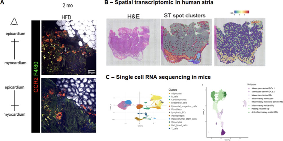 Mouse model of the atrial cardiomyopathy revealed immune cells infiltration in epicardium