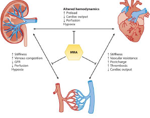 Beneficial effects of mineralocorticoid receptor (MRA) antagonists in nephro-cardiology