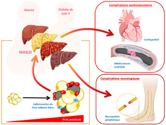 Inter-organ interactions and systemic complications in metabolic diseases: focus on adipose tissue, the liver, the heart, and the peripheral nervous system